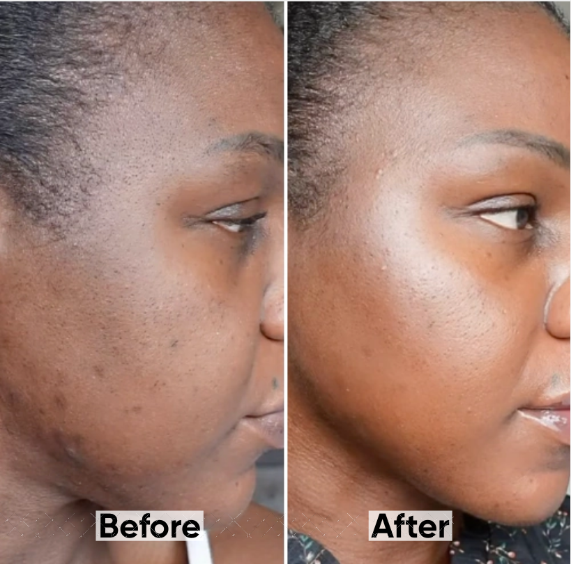 Radiant Glow LED Facial Mask and Neck™